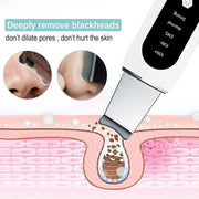 Face Blackhead Remover | Blackhead Remover Device | Essentialshouses