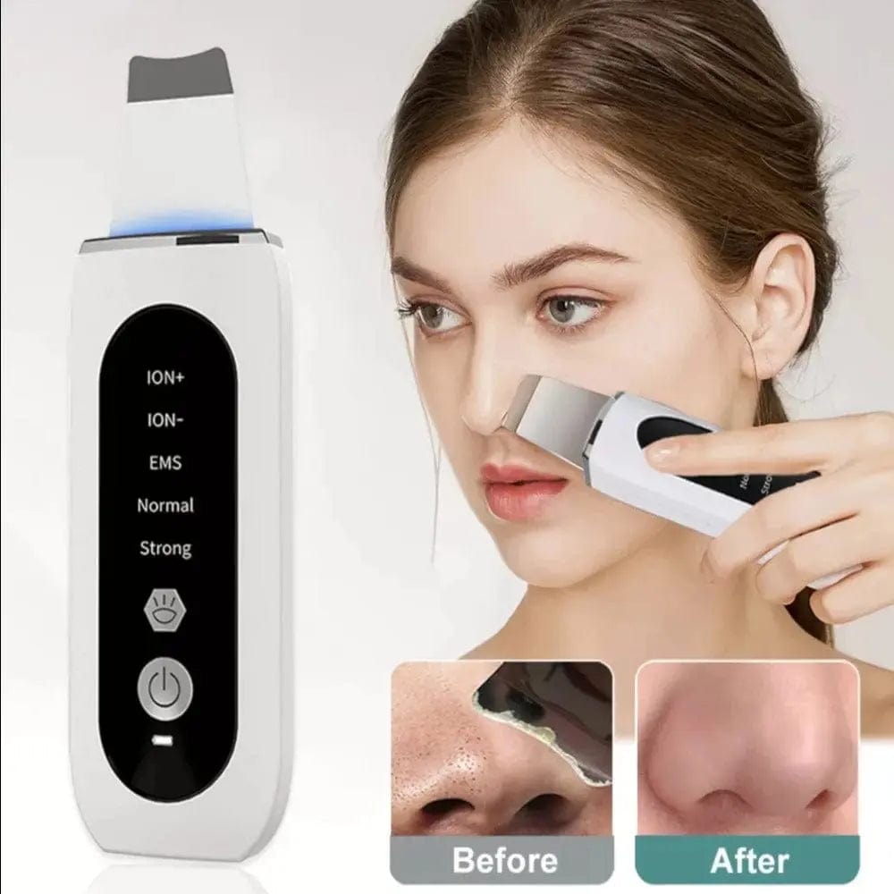 Face Blackhead Remover | Blackhead Remover Device | Essentialshouses