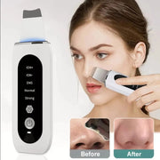 Face Blackhead Remover | Blackhead Remover Device | Essentialshouses
