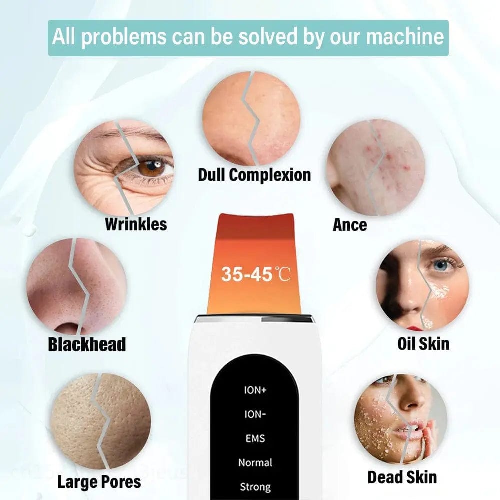 Face Blackhead Remover | Blackhead Remover Device | Essentialshouses