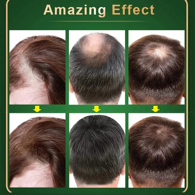 Hair Growth Orginal Natural Oil - Essentialshouses